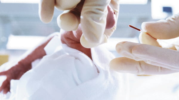 사용중인 Clinitube 모세관 채혈튜브의 이미지