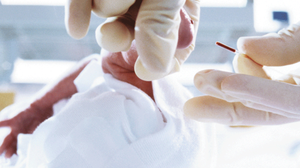 사용중인 Clinitube 모세관 채혈튜브의 이미지